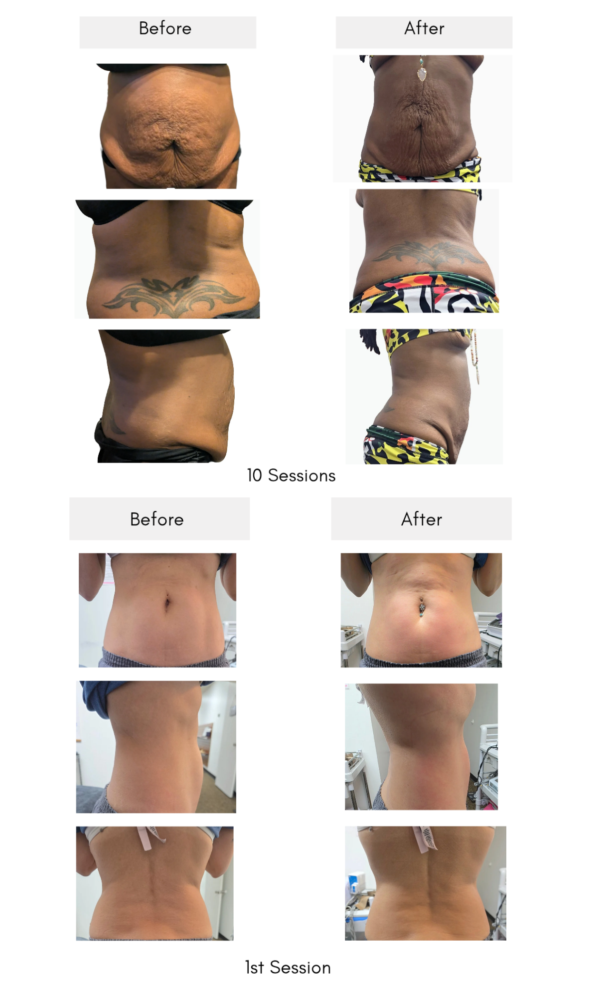 Real client progress from body contouring, lymphatic, and post-op care sessions.